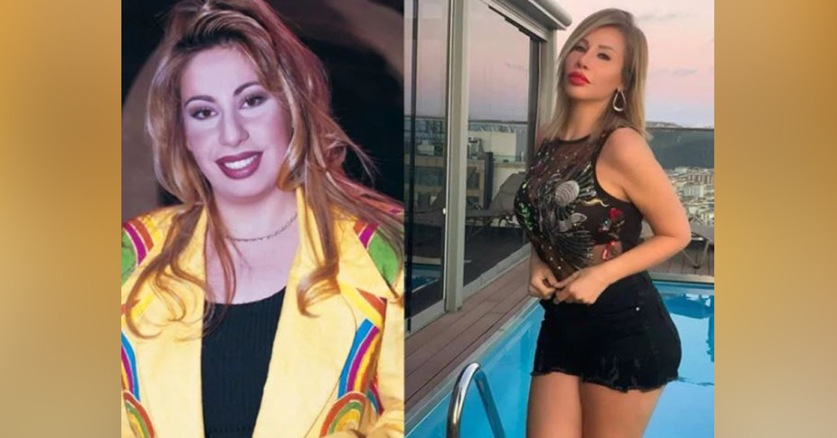 Ünlülerin zaman içerisindeki değişimi şaşırtıyor!