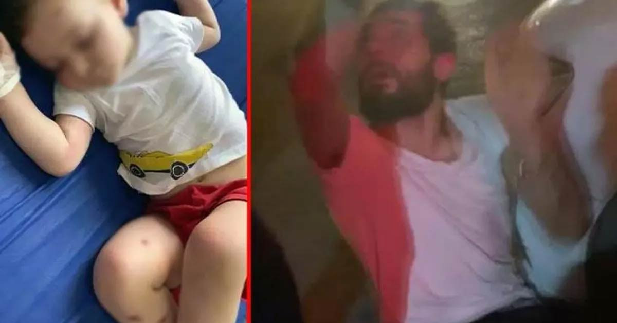 'Babam sigara söndürdü'