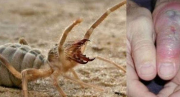 Adıyaman’da zehirli örümcek istilası! Sarıkız örümceği 1 metre zıplıyor ve tek ısırığıyla et koparıyor