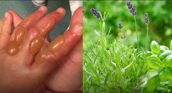 Bir çiçek hayatının sonunu getirdi! Bölgedeki yetkililer uyardı ‘Sakın dokunmayın!’