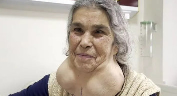 Boynunu gören uzmanlar dondu kaldı: Denizli'de ilginç olay! Doktor korkusuyla hastaneye gitmeyince...