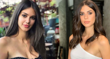 Deren Talu'nun Estetiksiz Görüntüleri Ortaya Çıktı! Görenler Gözlerine İnanamadı