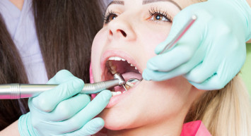 Diş tartarı nasıl geçer?