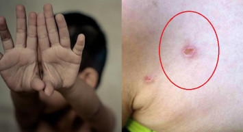 Diyarbakır’da akılalmaz olay! Anne oğlunu duş aldırırken vücudundaki detayı fark etti! Baba suçlanıyor