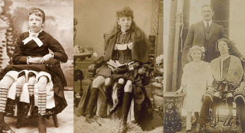 Dört bacak ve iki rahimle doğan kadın Myrtle Corbin'nin hayat hikayesi