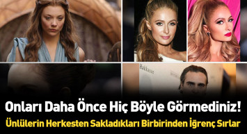 Dünyaca ünlü yıldızların hiç bilinmeyen kusurları