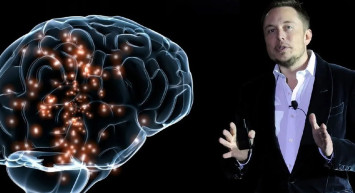 Dünyada ilk kez bir insanın beynine çip takmıştı! Son gelişmeleri açıkladı: Şok olacaksınız!