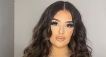 Estetik kurbanı olan kadın kendini tanıyamaz hale geldi