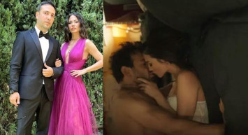 Estetik yaptıran erkek ünlüler