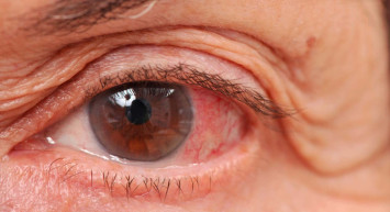 Göz tansiyonuna ne iyi gelir, hangi bitkiler iyi gelir? Göz tansiyonuna ilaç olan 10 besin