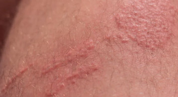 Her şey o diziyle başladı! Uzmanlar uyarıyor: ‘Üzerine işemeyin...’