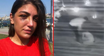 Manken Gizem Akbaş Eski Sevgilisi Tarafından Darp Edildi