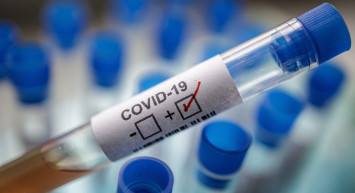 Omicron Son Varyant Olmayacak: Yenisi Geliyor Ve Daha Bulaşıcı!