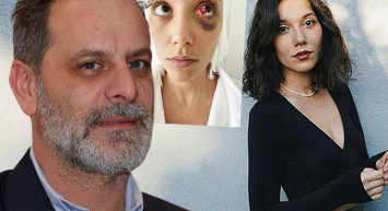 Ozan Güven'in eski sevgilisi Deniz Bulutsuz'u darp ettiği davada son gelişme: Adli Tıp Kurumu raporu hazırladı