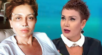 Seda Sayan’ın estetik doktoruna giden Serap Paköz değişimiyle herkesi şaşırttı! Kimse tanıyamıyor