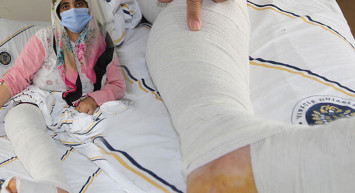 Varis Sandığı Şiş 10 Kiloluk Tümör Çıktı!