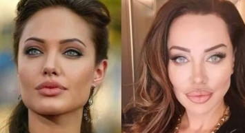 Yerli Adriana Lima Umut Akyürek güzelleşmek için yüzüne sülük yapıştırdı bin pişman olan Akyürek'in o hali herkese ders oldu