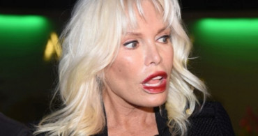 Ajda Pekkan'ın Dünden Bugüne Geçirdiği Estetik Operasyonlar