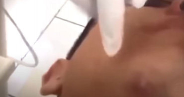 Çenesindeki Şişliği Sivilce Sandı Gerçek ise Dehşete Düşürdü