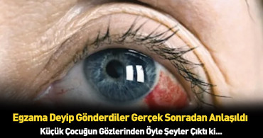 Egzama dediler kasık biti çıktı: Küçük çocuğın başına gelmeyen kalmadı!
