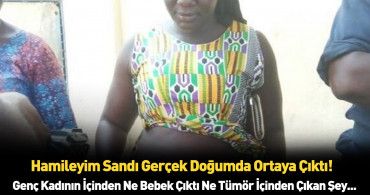 Güney Afrika'da eşi benzeri olmayan doğum olayı