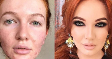 Kusurlu Yüzlerin Makyajla Değişen Görünümleri! Şok Olacaksınız