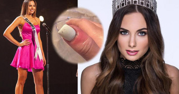 Güzel Model Karolina Jasko Kanseri Şans Eseri Atlattı