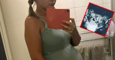 Molar gebelik geçiren Lauren Knowles tümör doğurdu