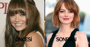 Bir Anda Güzelleşmedi! Emma Stone'un Şaşırtan Güzellik Evrimi