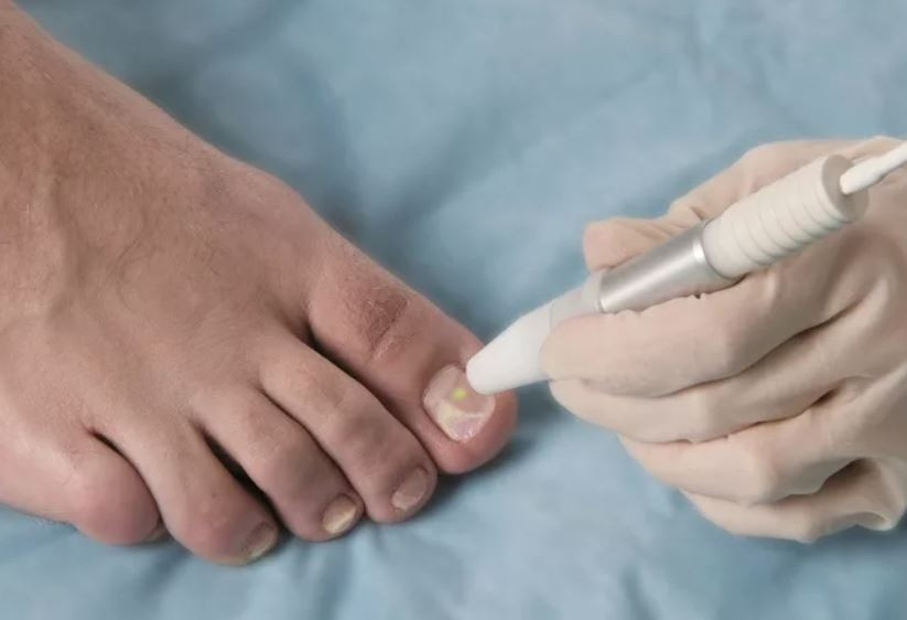 TIRNAK MANTARINA BİTKİSEL ÇÖZÜM