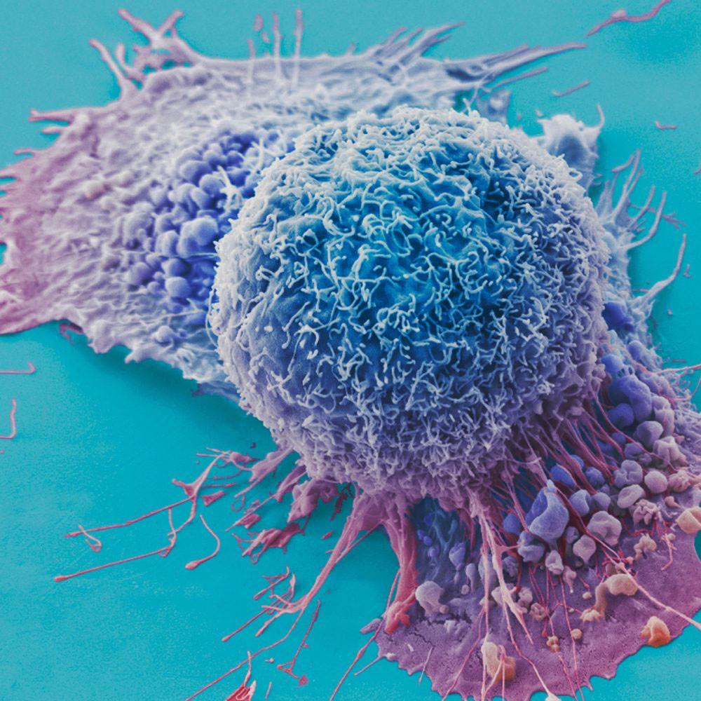 EK TEDBİRLER ALINMALI 