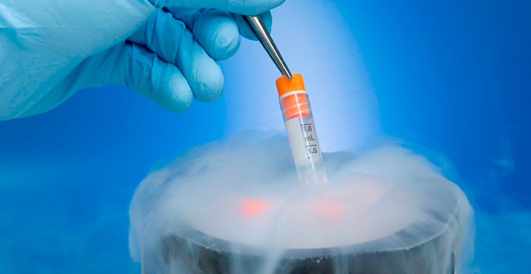 Yumurta Dondurma İşlemine Ne Zaman Başlanmalı?