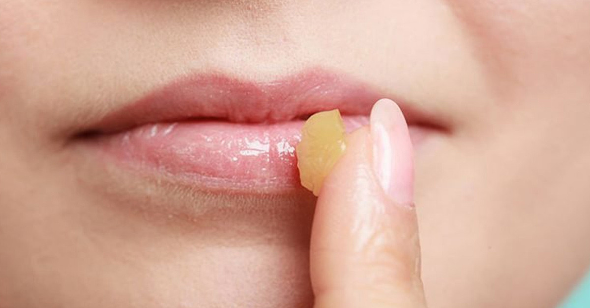 SERTLEŞMİŞ NOKTALARI YUMUŞATMA