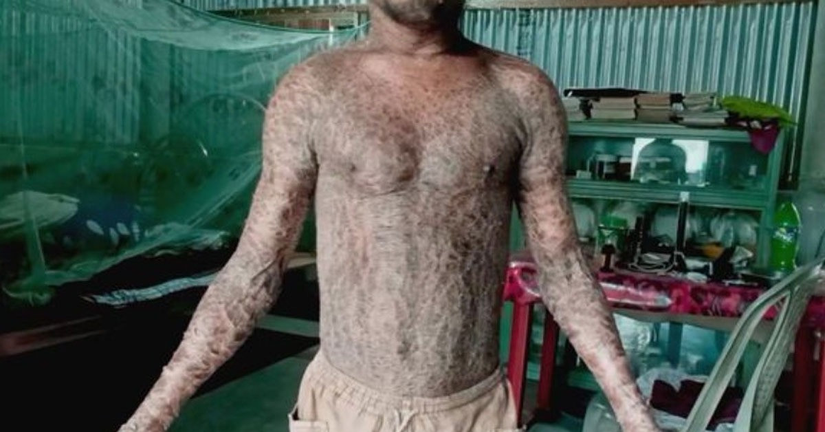 Doktorlar da çaresiz