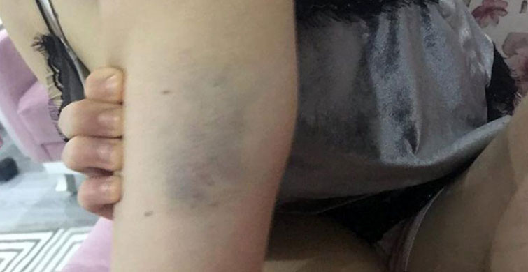 ''YERE YIĞILIP KALDIM''