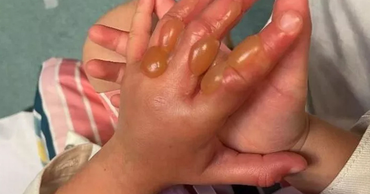 Elinde yaralar çıktı 