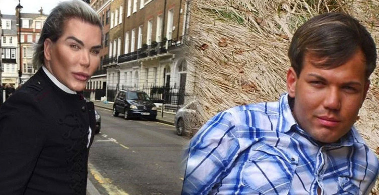 Barbie'nin sevgilisi Ken bebeğe benzemek için ameliyat olan Rodrigo Alves
