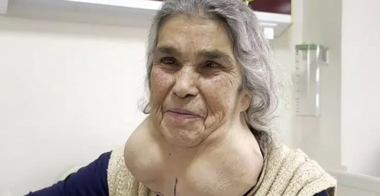 Boynunu gören uzmanlar dondu kaldı: Denizli'de ilginç olay! Doktor korkusuyla hastaneye gitmeyince...