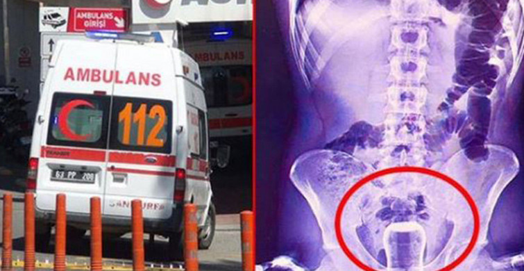'Bu buraya nasıl girdi?' diyeceğiniz birbirinden garip röntgen filmleri!