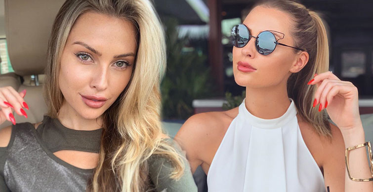 Chloe Louhgnan Estetik Sonrası Şiş Yüzü İle Görüntülendi