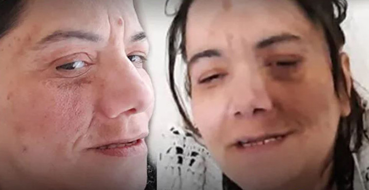 Damak Ağrısı Diye Gitti Yanlış Tedavi Yüzünden Hayatı Karardı