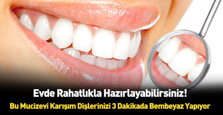 Dişleri 3 dakikada bembeyaz yapan formül