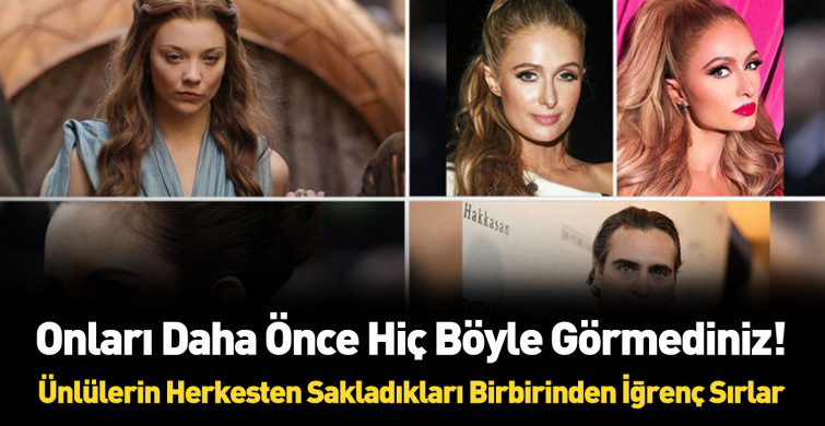 Dünyaca ünlü yıldızların hiç bilinmeyen kusurları