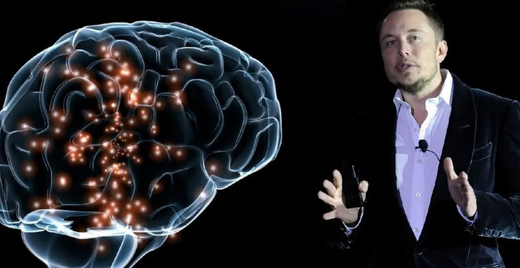 Dünyada ilk kez bir insanın beynine çip takmıştı! Son gelişmeleri açıkladı: Şok olacaksınız!