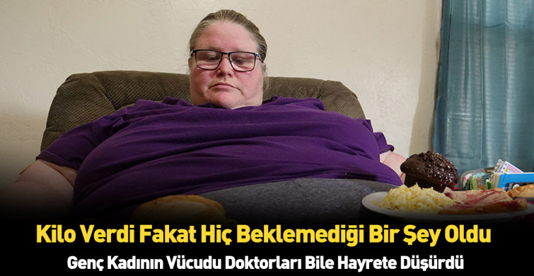 Kilo verdikten sonraki hali görenleri şoke ediyor!