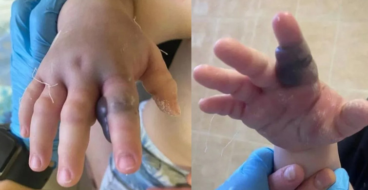 Küçük bebek engerek yılanının kurbanı oldu! Annesi fark edene kadar zehir yayıldı bebeğin son halini görenler inanamadı