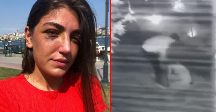 Manken Gizem Akbaş Eski Sevgilisi Tarafından Darp Edildi
