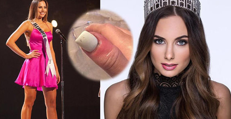 Güzel Model Karolina Jasko Kanseri Şans Eseri Atlattı