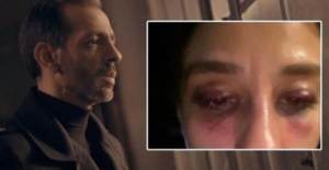 Sevgilisi Burcu Yılmaz'ı Darp Eden Özer Arkun'un İfadesi Ortaya Çıktı