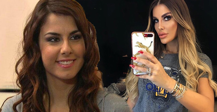 Tuğçe Özbudak'tan Estetik Açıklaması